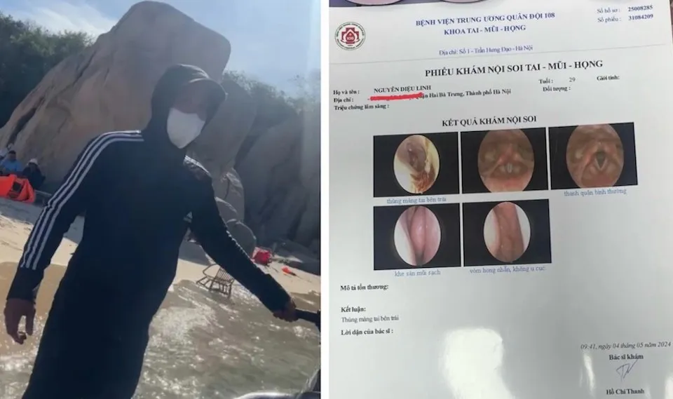 Làm rõ việc du khách Hà Nội bị hành hung thủng màng nhĩ tại Ninh Thuận