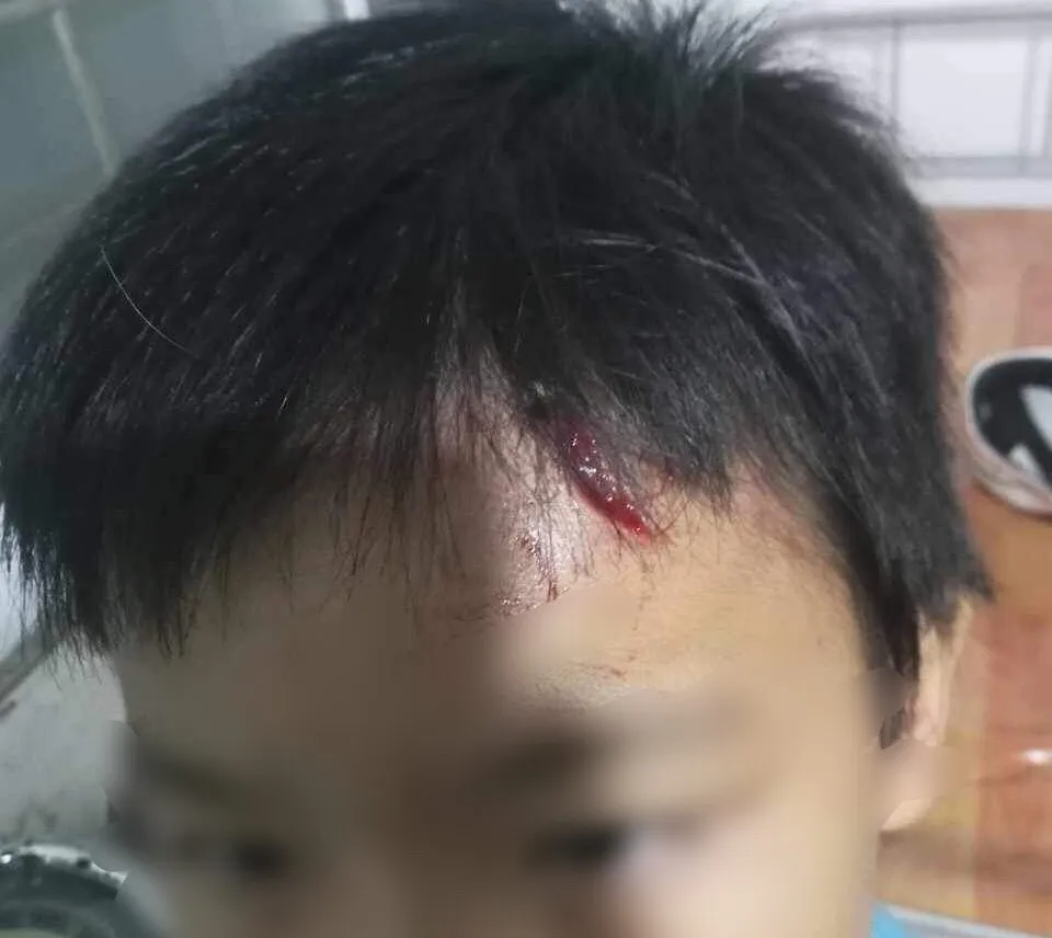 Xác minh vụ mẹ kế tái bạo hành con chồng ở Cà Mau