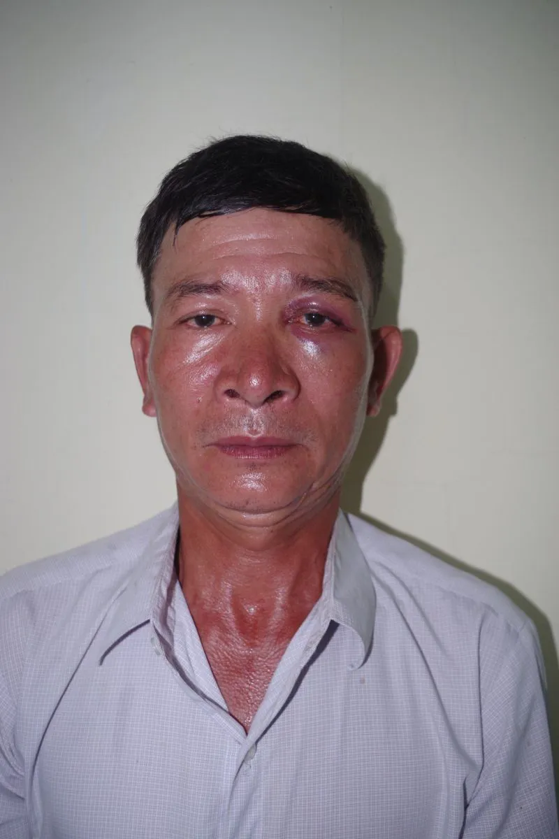 Thanh Hóa: bắt đối tượng lẻn vào bệnh viện làm chuyện xấu