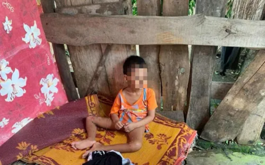 Nghệ An: thông tin về vụ cháu bé 5 tuổi nghi bị ngược đãi, bạo hành
