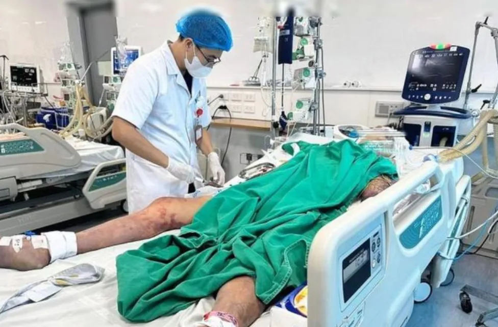 Ăn tiết canh để "lấy may", nam thanh niên nguy kịch vì liên cầu lợn